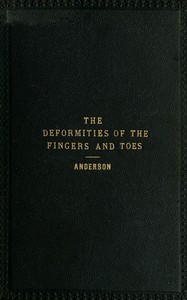 The deformities of the fingers and toes by William Anderson